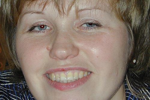 Images/fzwnfr20.jpg